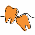 Illustration of two overlapping teeth, symbolizing dental crowding