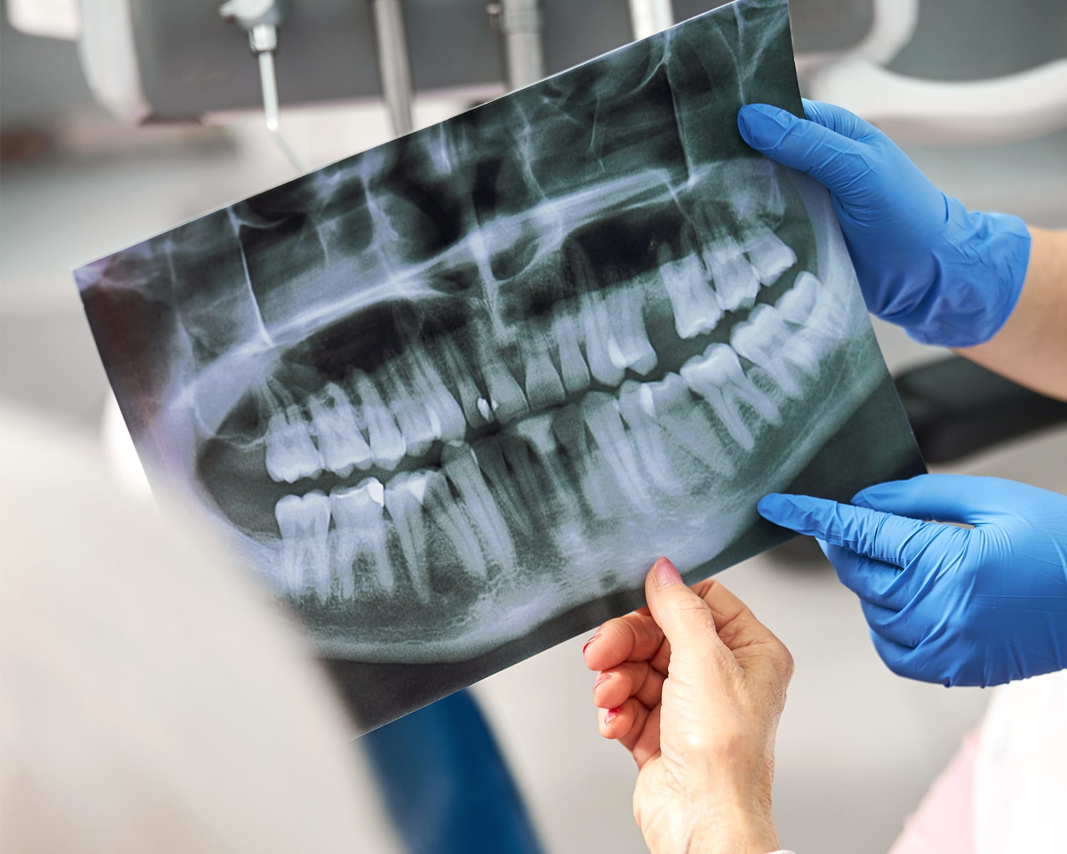 Dentist displaying dental X-ray of teeth to patient during exam