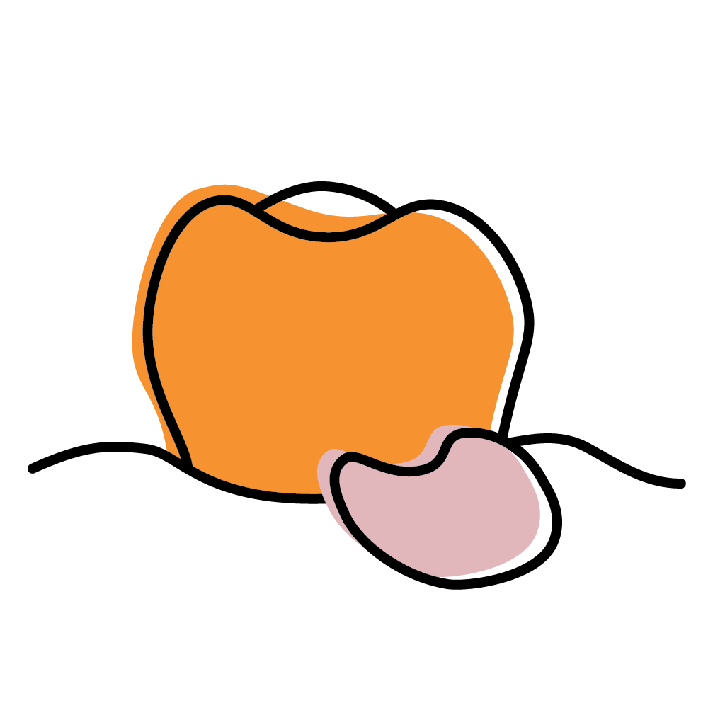 Illustration of a tooth with a pink swelling at the gumline, indicating pus or an abscess