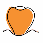 Illustration of a tooth with lowered gumline, showing signs of gum recession