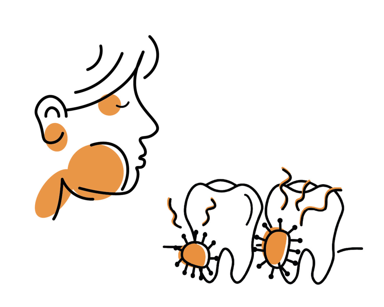 Illustration of a person with swollen cheek beside infected teeth with bacteria