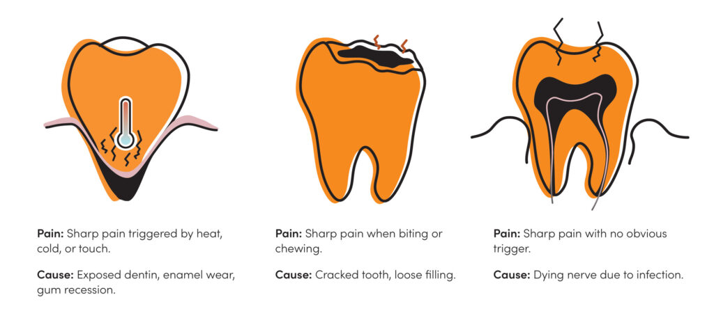 Illustration showing causes of sudden sharp tooth pain: sensitivity, cracked tooth, and infected nerve with pain triggers and causes