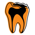 Illustration of a broken tooth with visible damage to the enamel
