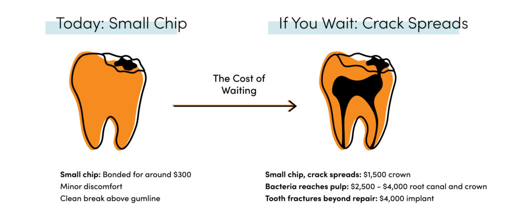 Chipped tooth infographic showing cost of waiting, from $300 bonding to $4,000 implant if untreated