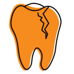 Illustration of a cracked tooth showing visible damage and dental fracture