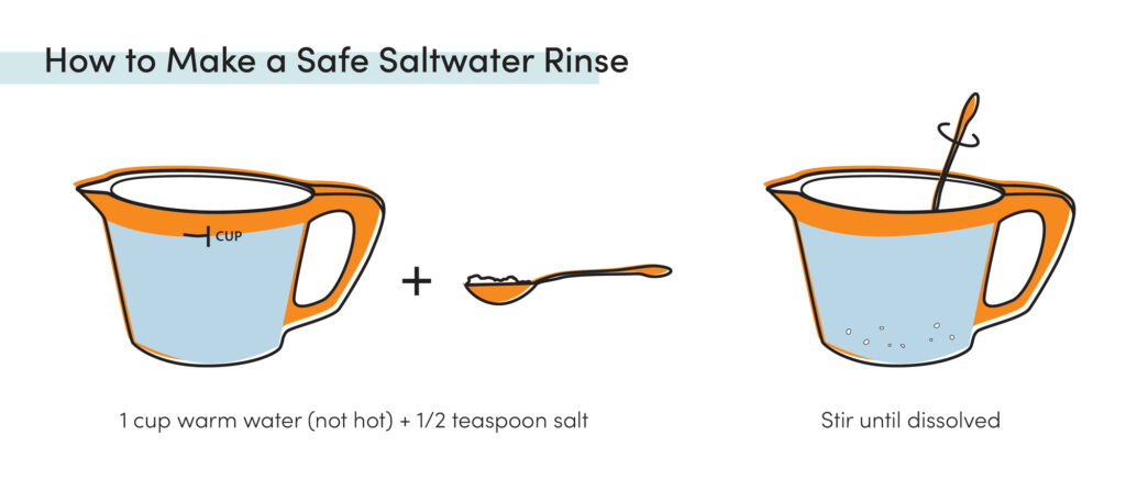 How to make a safe saltwater rinse with 1 cup warm water and 1/2 teaspoon salt for dental healing