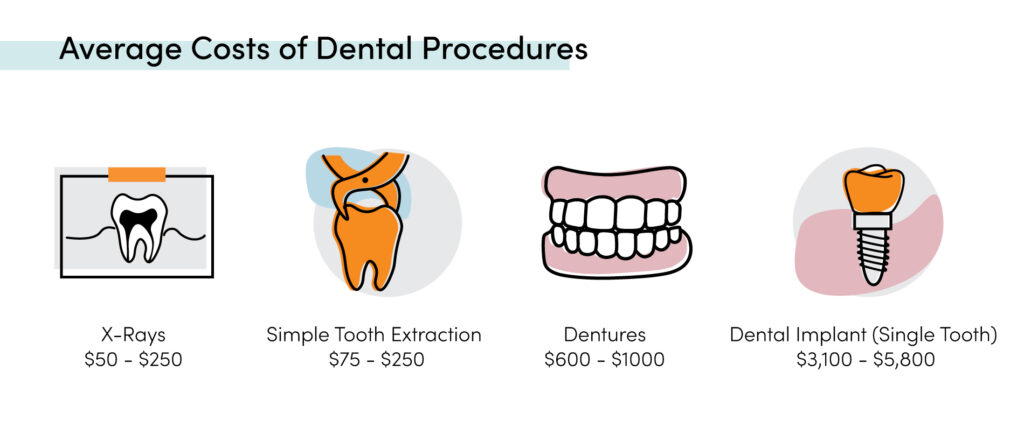 Average costs of dental procedures including X-rays, tooth extraction, dentures, and dental implants price ranges