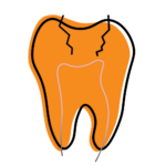 Illustration of a large orange tooth with cracked crown and inner root outline showing damage to tooth structure