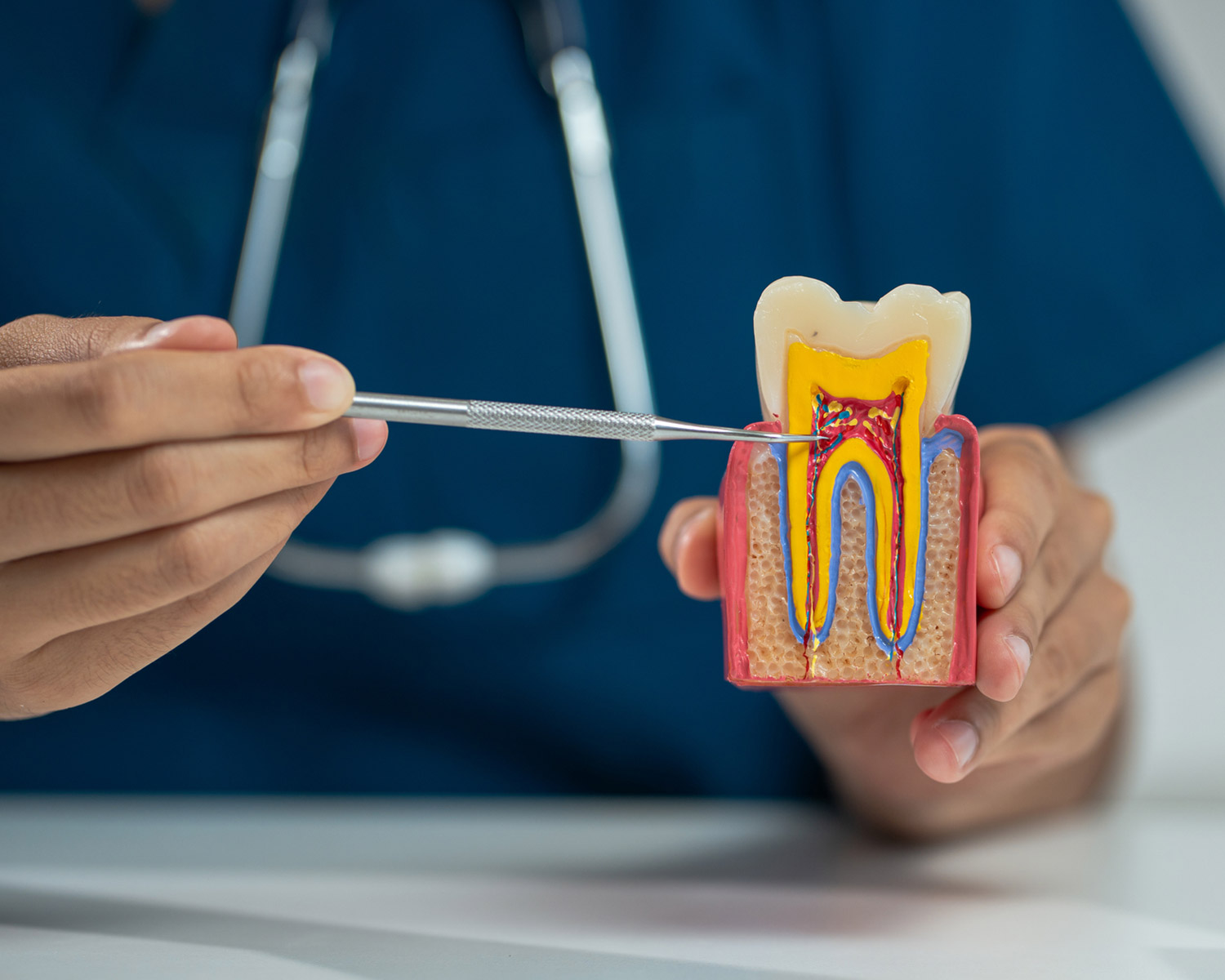 Dentist explaining root canal treatment using tooth cross-section model showing infected pulp and tooth anatomy