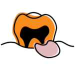 Cartoon tooth with orange outer shape, black cavity, and a pink tongue resting on a wavy line.