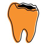 Visible tooth damage illustration showing cracked tooth with decay and signs of severe dental problems