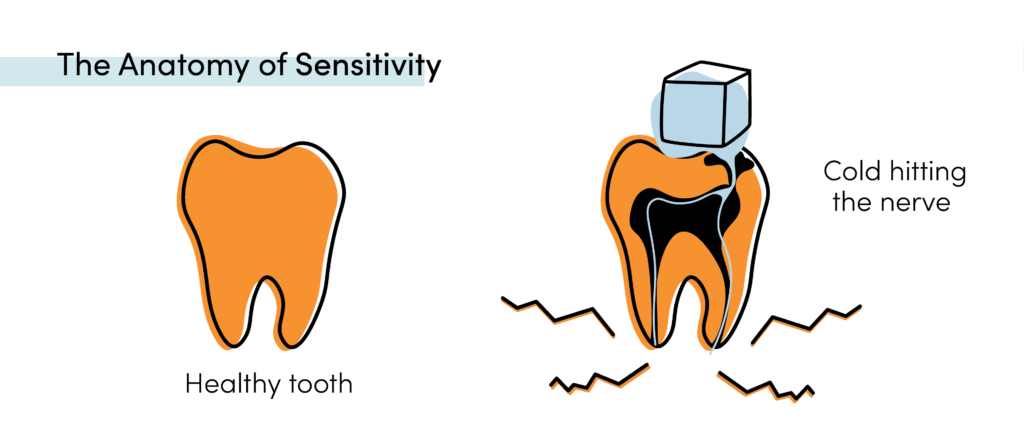 Tooth sensitivity diagram showing cold reaching the nerve and causing pain in a damaged tooth
