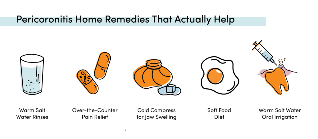 Pericoronitis remedies infographic showing saltwater rinses, OTC pain relief, cold compress, soft foods, and warm mouth irrigation.