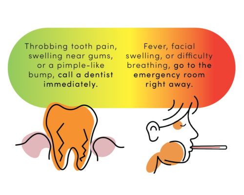 Infographic about dental emergencies: left panel shows call a dentist for tooth pain and swelling; right panel says go to the ER for fever, facial swelling, or trouble breathing.
